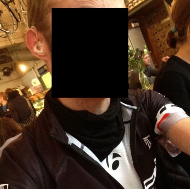 Велосипедист с редчайшим генетическим заболеванием - полное отсутствие жира в организме MDP-синдром, Том Станифорд, без жира, велосипедист