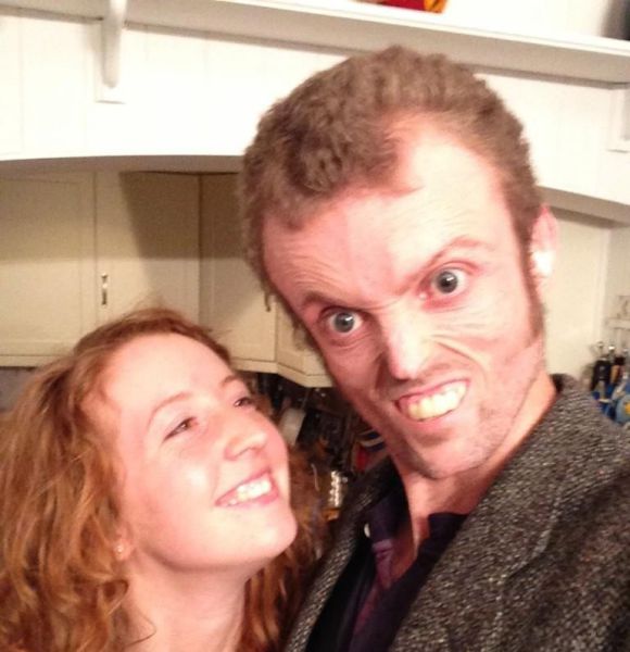 Велосипедист с редчайшим генетическим заболеванием - полное отсутствие жира в организме MDP-синдром, Том Станифорд, без жира, велосипедист